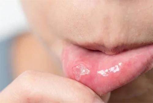 1628731000324285.jpg t01610976e3884cafe8.webp.jpg