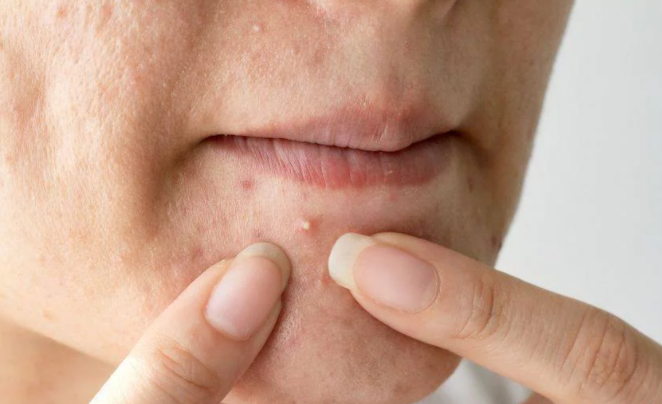 1658544214366749.png 1658544208(1).png